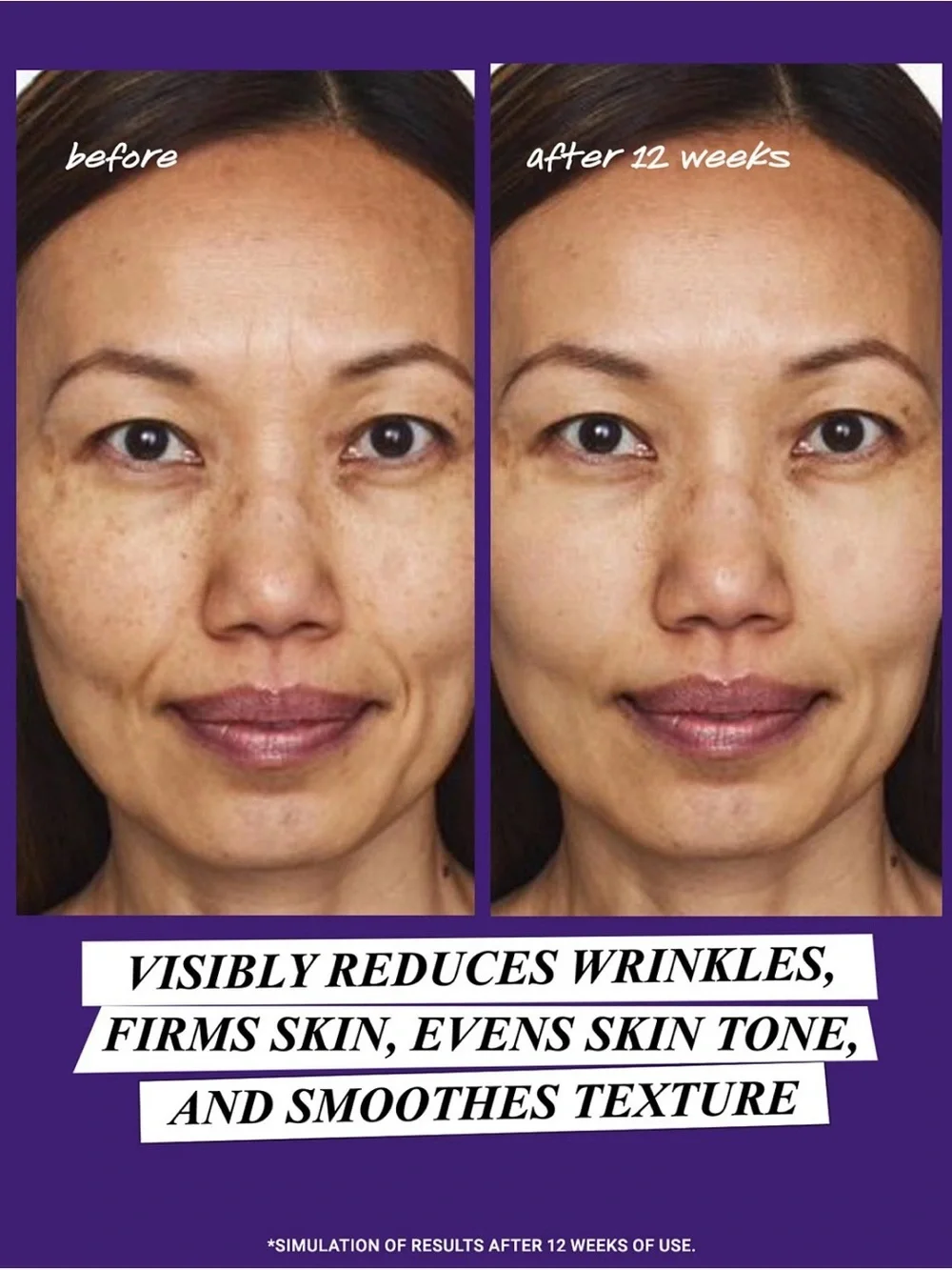 Kiehl's Retinol Skin-Renewing Daily Micro-Dose Serum